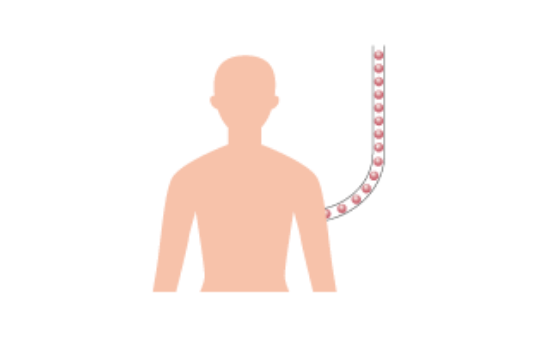 管を通りFDGが人体に注入するイラスト