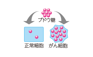 PET検査の仕組み1